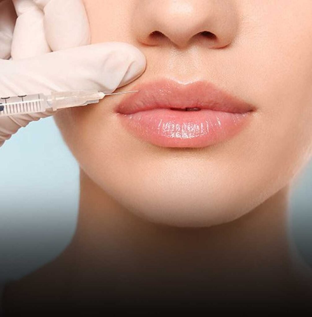 Derm Fillers