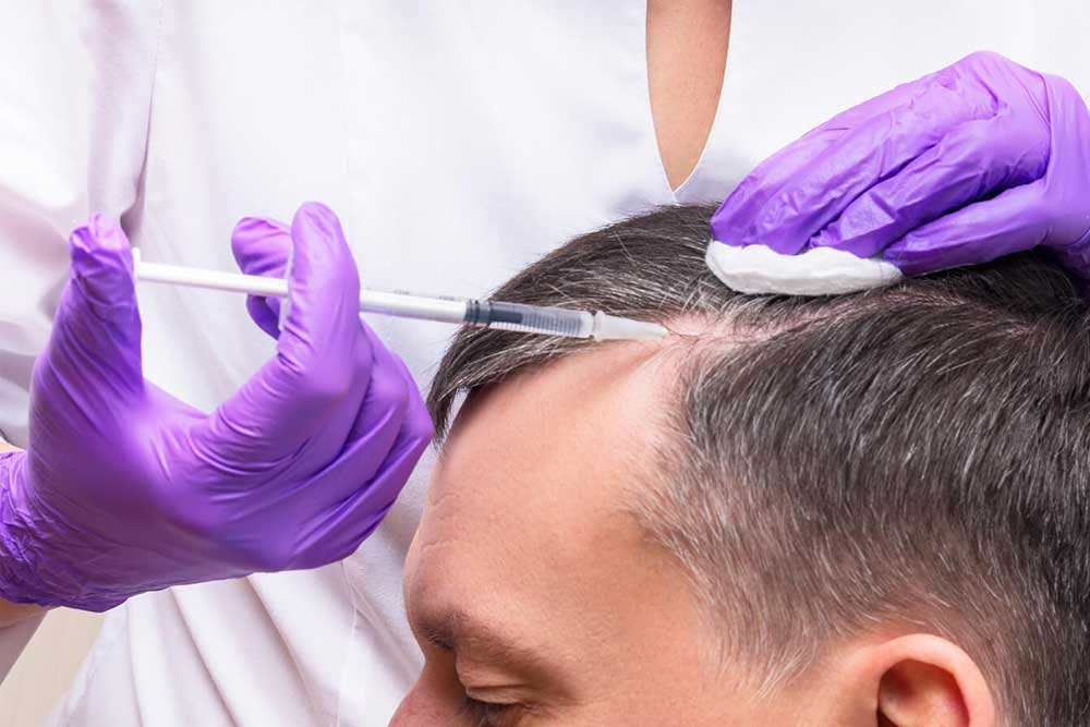 How Does PRP for Hair Restoration Work?