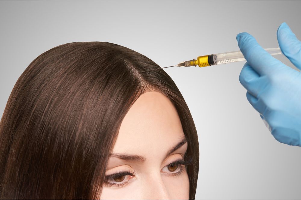 PRP hair restoration treatment in New Orleans to promote natural hair growth and reduce hair loss