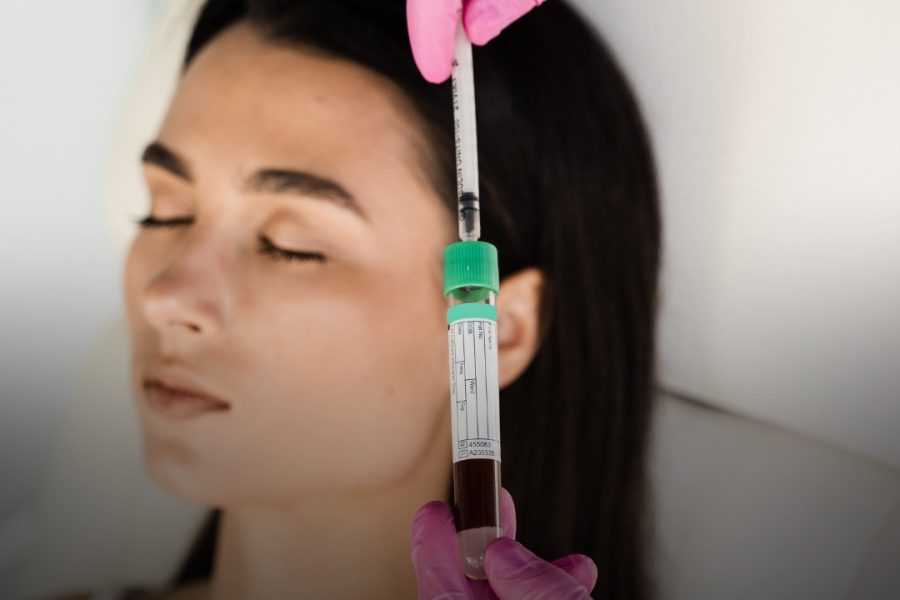 Platelet Rich Plasma