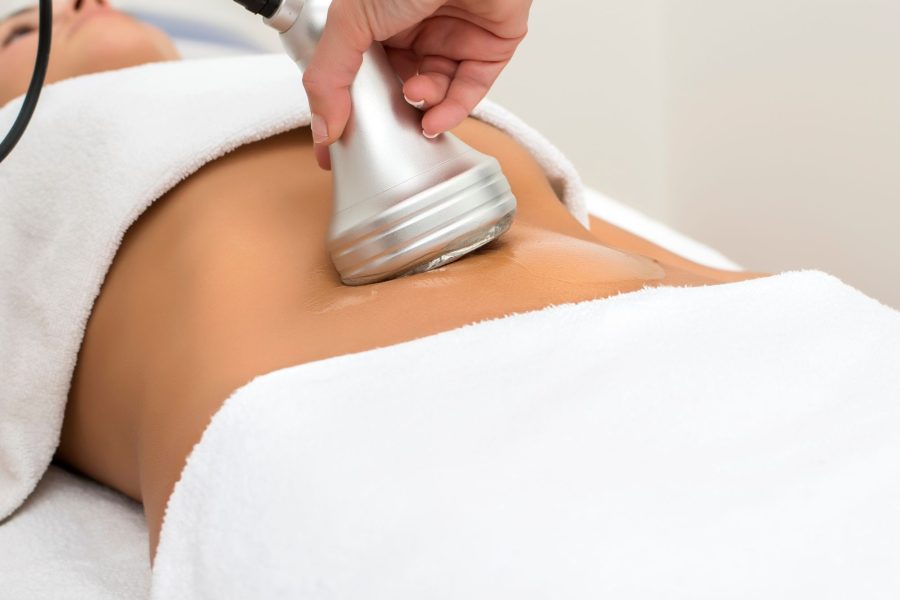 this image shows the process of Radio frequency body sculpting